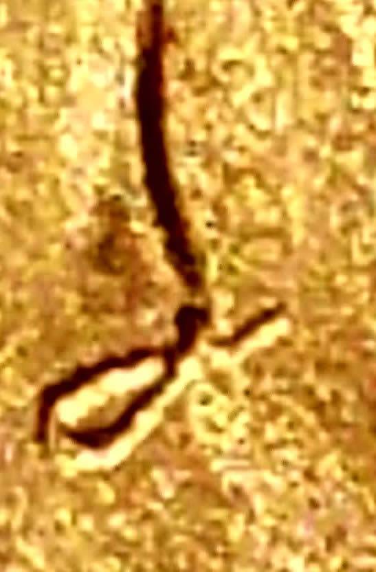 2018-P-Lincoln-Looped-Struck-Through-On-Bust-Of-The-Obverse?